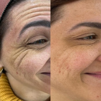 Clínica de Harmonização Facial Clínica de Harmonização Facial