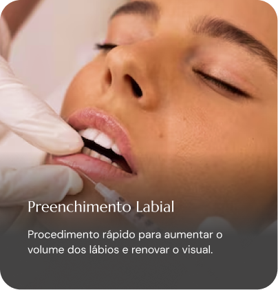 Preenchimento Labial