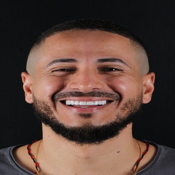 O que são lentes de porcelana dentárias? O que são lentes de porcelana dentárias?
